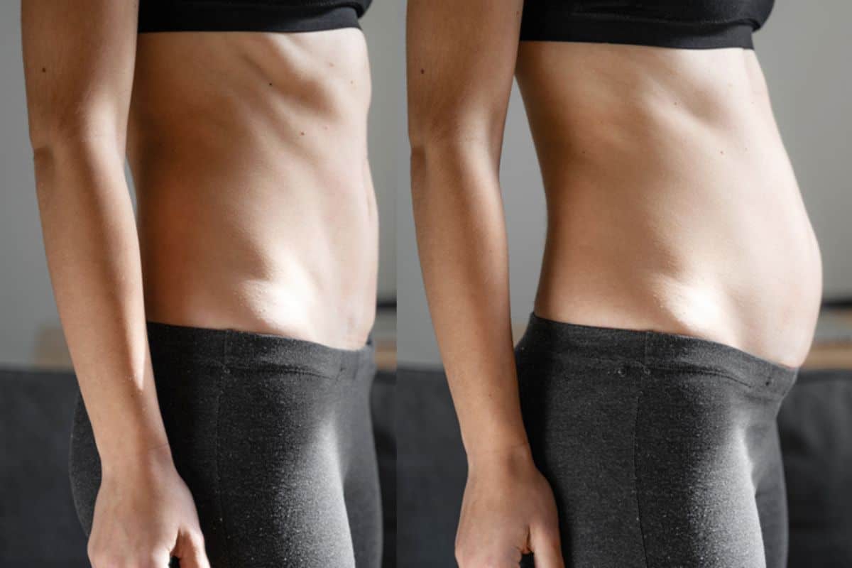 How long does diastasis recti take to improve Farnborough?