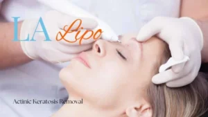 Woman receiving Actinic Keratosis Removal Treatment Farnborough
