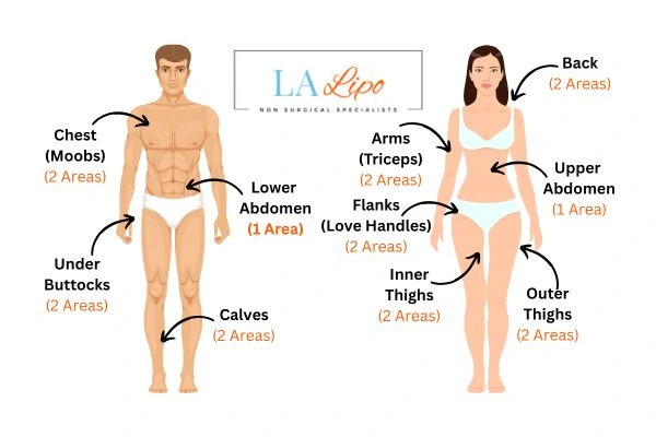 LA LIPO Cryolipolysis Areas Farnborough