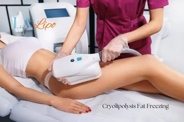 Woman receiving coolsculpting Farnborough treatment on her thighs