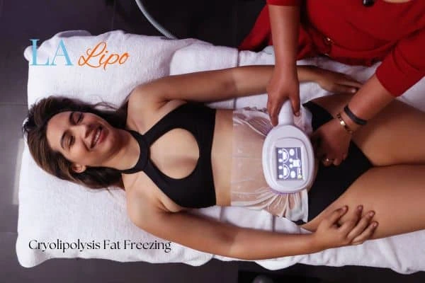 woman getting cryolipolysis Farnborough