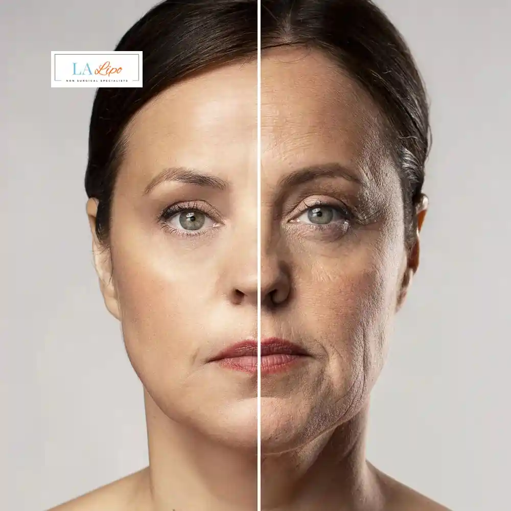 How Can You Tell If Non-Surgical Skin Tightening Is Right for You Farnborough?