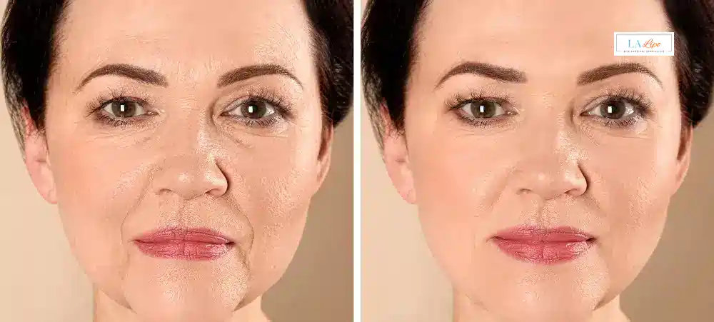 How Long Does It Take to See Results and How Long Do They Last Farnborough?